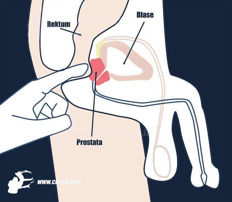 Prostata finden schematische Zeichnung Check.Toys
